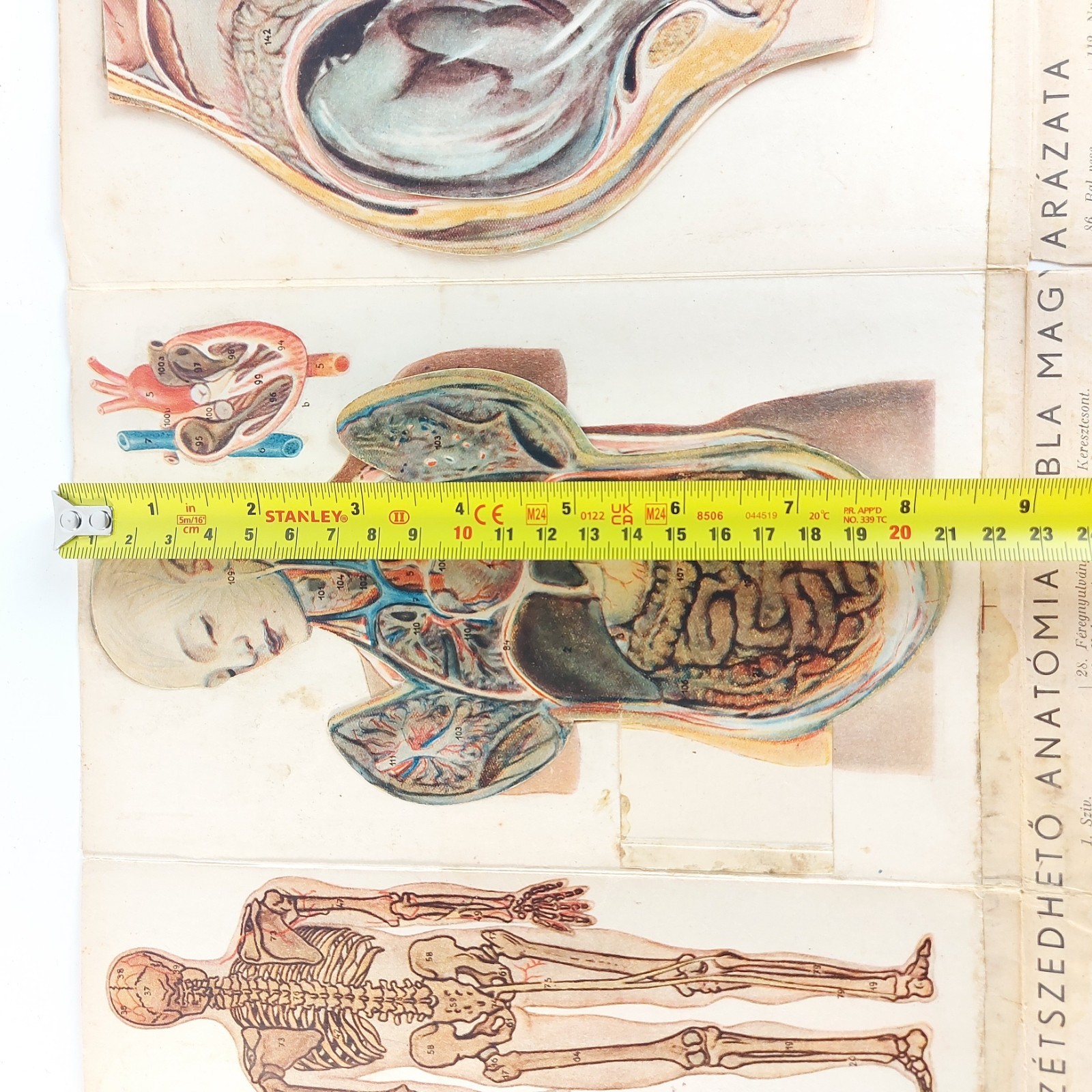 Old Antique Anatomy Illustration Skeleton Pregnancy Organs c.1910s Hungary
